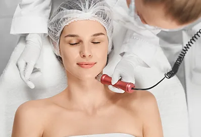 MicroNeedling